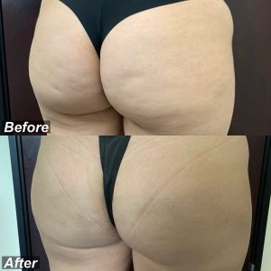 160B5013-3C96-401F-AF0E-66D508C60272