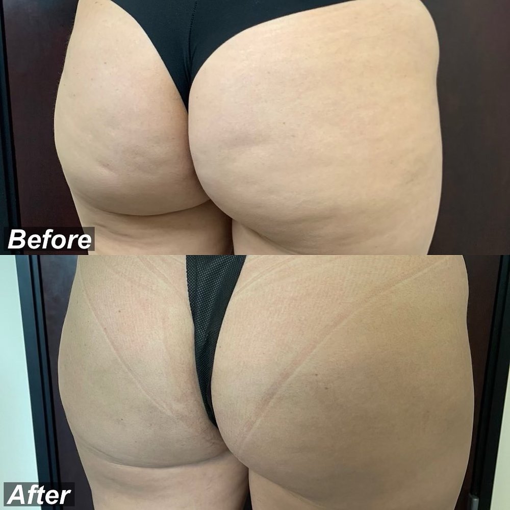 160B5013-3C96-401F-AF0E-66D508C60272