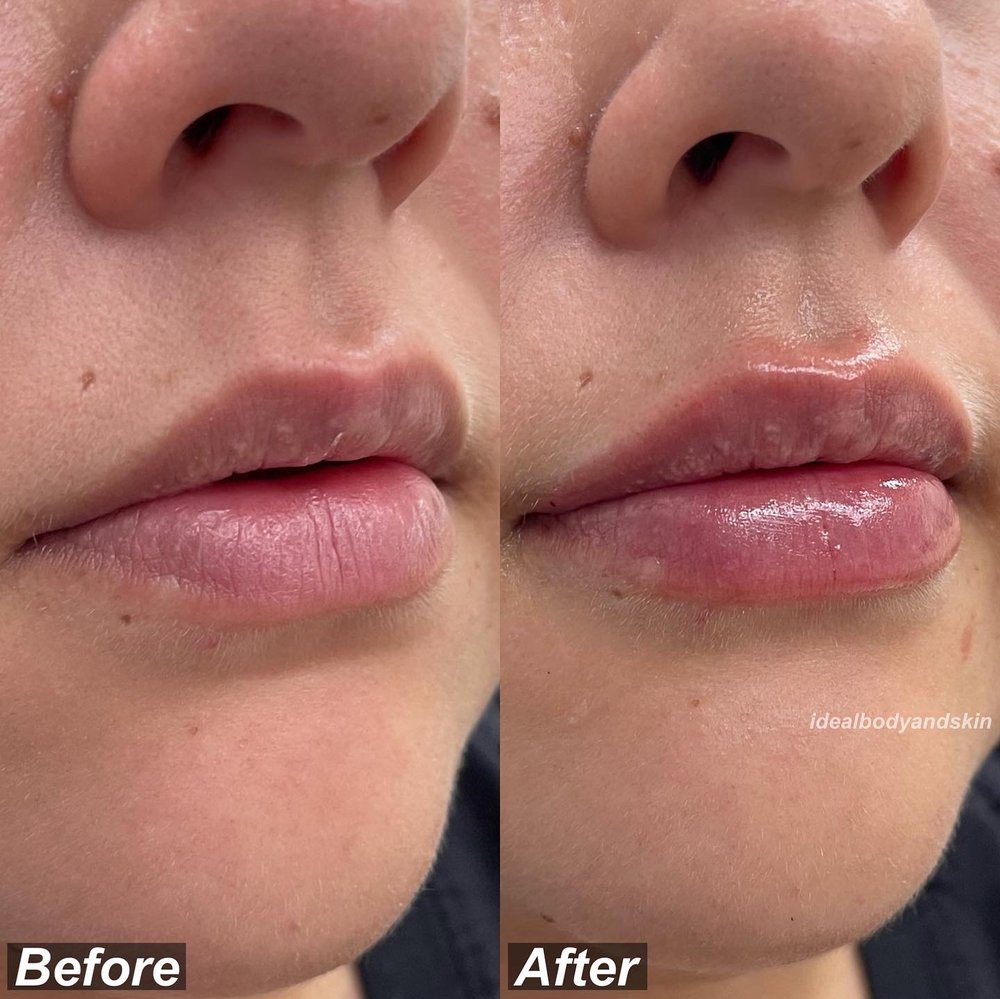 53E75BE6-2225-4C03-A402-3D7D2361C556