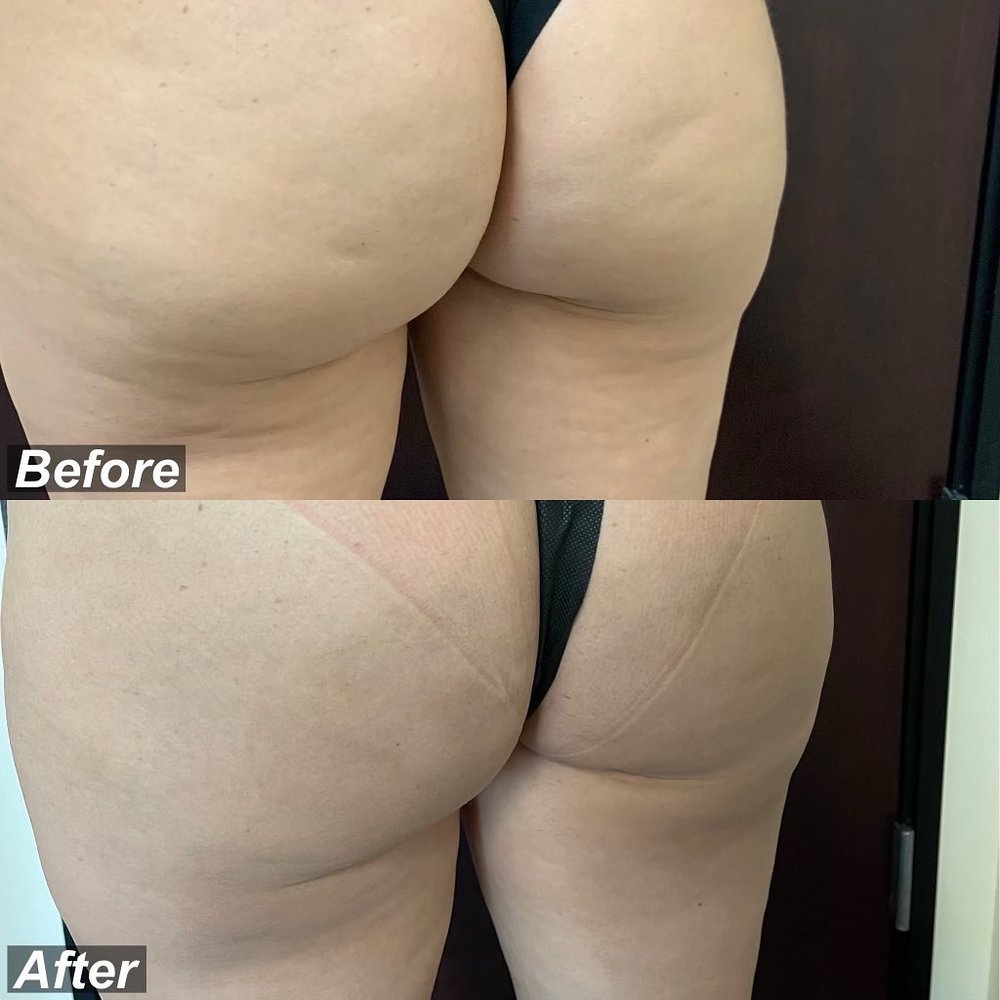 56EEBB72-CFEB-4F3F-8443-DA2408D67C32