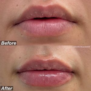 7A6DAA44-3534-4DF5-ADFB-FB13AD5BA938