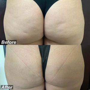 F74EA75C-EDFF-404E-BBA4-65A8440BF9D7